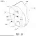 Fig. 09 - GUIDES AND INSTRUMENTS FOR IMPROVING ACCURACY OF GLENOID IMPLANT PLACEMENT