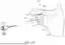 Fig. 33 - GUIDES AND INSTRUMENTS FOR IMPROVING ACCURACY OF GLENOID IMPLANT PLACEMENT