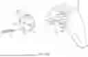 Fig. 34 - GUIDES AND INSTRUMENTS FOR IMPROVING ACCURACY OF GLENOID IMPLANT PLACEMENT