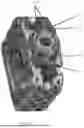 Fig. 02 - SPINAL IMPLANT