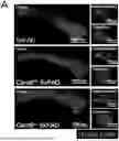 Fig. 01 - CARD9 ATTENUATES AB PATHOLOGY AND MODIFIES MICROGLIAL RESPONSES IN AN ALZHEIMER’S DISEASE