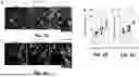 Fig. 06 - CARD9 ATTENUATES AB PATHOLOGY AND MODIFIES MICROGLIAL RESPONSES IN AN ALZHEIMER’S DISEASE