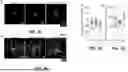 Fig. 07 - CARD9 ATTENUATES AB PATHOLOGY AND MODIFIES MICROGLIAL RESPONSES IN AN ALZHEIMER’S DISEASE