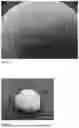 Fig. 02 - COMPOSITION OF SUBSTANTIALLY SPHERICAL GRANULE FOR BONE REGENERATION