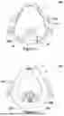 Fig. 06 - PATIENT INTERFACE AND A SPEECH VALVE THEREFOR