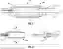 Fig. 02 - BLOOD PUMP WITH IMPROVED LEAKAGE CONTROL