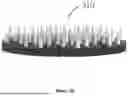 Fig. 07 - Gastric Electrical Stimulation System
