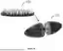 Fig. 08 - Gastric Electrical Stimulation System