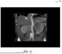 Fig. 16 - METHODS AND SYSTEMS FOR GENERATING DUAL-ENERGY IMAGES FROM A SINGLE-ENERGY IMAGING SYSTEM