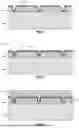 Fig. 03 - METHODS AND STRUCTURES FOR INCREASING CAPACITANCE DENSITY IN INTEGRATED PASSIVE DEVICES