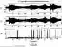 Fig. 05 - ACOUSTIC VOICE ACTIVITY DETECTION (AVAD) FOR ELECTRONIC SYSTEMS