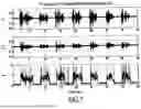 Fig. 06 - ACOUSTIC VOICE ACTIVITY DETECTION (AVAD) FOR ELECTRONIC SYSTEMS