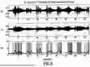 Fig. 07 - ACOUSTIC VOICE ACTIVITY DETECTION (AVAD) FOR ELECTRONIC SYSTEMS