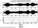 Fig. 08 - ACOUSTIC VOICE ACTIVITY DETECTION (AVAD) FOR ELECTRONIC SYSTEMS