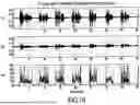 Fig. 09 - ACOUSTIC VOICE ACTIVITY DETECTION (AVAD) FOR ELECTRONIC SYSTEMS