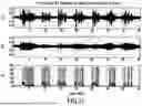 Fig. 10 - ACOUSTIC VOICE ACTIVITY DETECTION (AVAD) FOR ELECTRONIC SYSTEMS