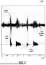 Fig. 15 - ACOUSTIC VOICE ACTIVITY DETECTION (AVAD) FOR ELECTRONIC SYSTEMS