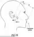 Fig. 16 - ACOUSTIC VOICE ACTIVITY DETECTION (AVAD) FOR ELECTRONIC SYSTEMS