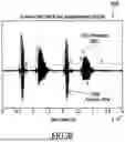 Fig. 18 - ACOUSTIC VOICE ACTIVITY DETECTION (AVAD) FOR ELECTRONIC SYSTEMS