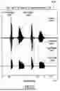 Fig. 19 - ACOUSTIC VOICE ACTIVITY DETECTION (AVAD) FOR ELECTRONIC SYSTEMS