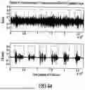 Fig. 36 - ACOUSTIC VOICE ACTIVITY DETECTION (AVAD) FOR ELECTRONIC SYSTEMS