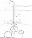 Fig. 01 - COLLAPSIBLE TUBE FOR HEMOSTASIS