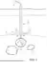 Fig. 02 - COLLAPSIBLE TUBE FOR HEMOSTASIS