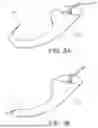 Fig. 04 - COLLAPSIBLE TUBE FOR HEMOSTASIS