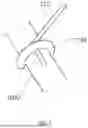 Fig. 09 - SPINE STABILIZATION SYSTEM