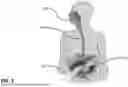 Fig. 02 - APPARATUS, SYSTEMS AND METHODS FOR SOFT TISSUE ABLATION
