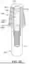 Fig. 11 - DENTAL PROSTHESIS SYSTEM FOR IMPLANT SCREW ANCHOR