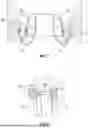 Fig. 06 - PROSTHETIC VALVES FOR DEPLOYMENT
