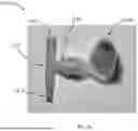 Fig. 22 - SYSTEMS, APPARATUS, AND METHODS FOR PLACING AND/OR CONFIRMING A LOCATION OF AN END OF A NASOGASTRIC OR AN OROGASTRIC TUBE
