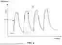 Fig. 07 - RADIATION IMAGING DEVICE AND RADIATION IMAGING SYSTEM