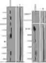 Fig. 01 - T CELL RECEPTORS WITH MAGE-B2 SPECIFICITY AND USES THEREOF