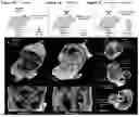Fig. 02 - COMPOSITIONS AND METHODS FOR PREVENTING OR AMELIORATING NEONATAL HSV INFECTION