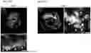 Fig. 100 - METHODS OF GENERATING A SYNTHETIC EMBRYO