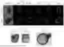 Fig. 12 - METHODS OF GENERATING A SYNTHETIC EMBRYO