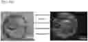 Fig. 80 - METHODS OF GENERATING A SYNTHETIC EMBRYO