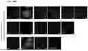 Fig. 89 - METHODS OF GENERATING A SYNTHETIC EMBRYO