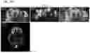 Fig. 98 - METHODS OF GENERATING A SYNTHETIC EMBRYO