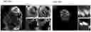 Fig. 99 - METHODS OF GENERATING A SYNTHETIC EMBRYO