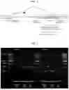 Fig. 02 - ANTISENSE OLIGONUCLEOTIDE AND COMPOSITION FOR PREVENTION OR TREATMENT OF GLYCOGEN STORAGE DISEASE TYPE IA