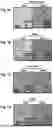 Fig. 02 - MEANS AND METHODS FOR REDUCING TUMORIGENICITY OF CANCER STEM CELLS