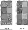 Fig. 07 - MEANS AND METHODS FOR REDUCING TUMORIGENICITY OF CANCER STEM CELLS