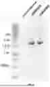 Fig. 06 - ADENO-ASSOCIATED VIRUS COMPOSITIONS AND METHODS OF USE THEREOF