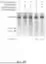 Fig. 06 - DELIVERY AND USE OF THE CRISPR-CAS SYSTEMS, VECTORS AND COMPOSITIONS FOR HEPATIC TARGETING AND THERAPY
