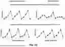 Fig. 10 - COMPENSATION OF ENVIRONMENTAL AND OPERATIONAL CONDITIONS IN ULTRASONIC TESTING OF STRUCTURES