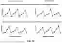 Fig. 11 - COMPENSATION OF ENVIRONMENTAL AND OPERATIONAL CONDITIONS IN ULTRASONIC TESTING OF STRUCTURES