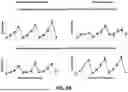 Fig. 13 - COMPENSATION OF ENVIRONMENTAL AND OPERATIONAL CONDITIONS IN ULTRASONIC TESTING OF STRUCTURES